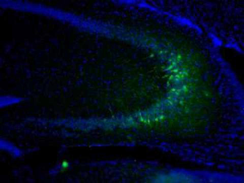 생쥐의 해마 사진. 해마의 핵은 푸른색으로, L1유전자는 초록색으로 표시됐다. ⓒ Salk Institute