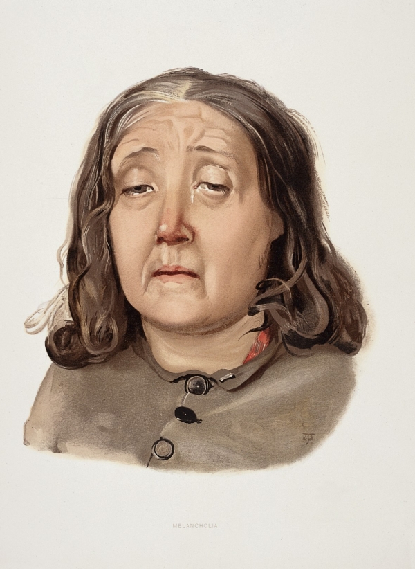 우울증 진단을 받은 여인을 그린 1892년의 리소그라피. credit : 위키피디아