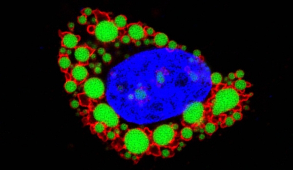 지방세포를 형광물질로 처리한 모습. 초록색 지방이 푸른색으로 들어가려면 붉은색 분자를 통과해야 한다. (사진=예일대학)