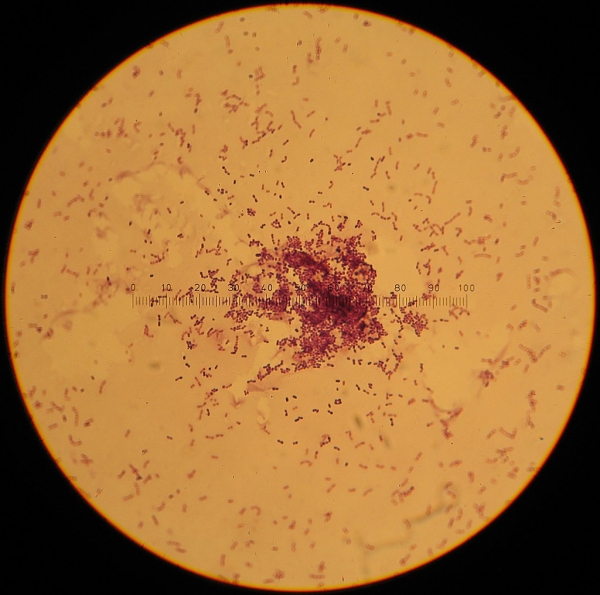 좋은 장내 미생물로 꼽히는 락토코커스 박테리아. (사진=위키피디아)