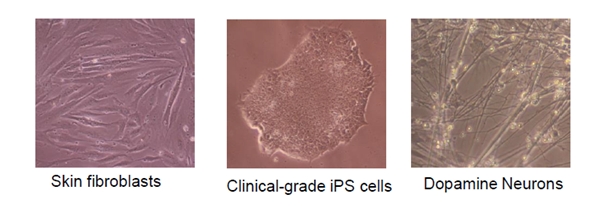 피부세포, 유도만능 줄기세포, 도파민 뉴런. (사진=KAIST)